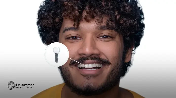 ايماكس سويسري بالصور